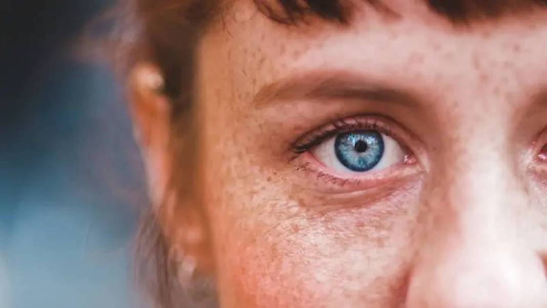 Bu fiziksel özelliklere sahipseniz şanslı azınlıktasınız! Doğuştan geliyor ve nadir bulunuyor 2